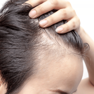 improve hair health